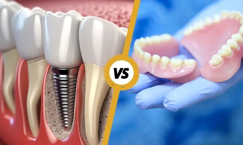 Dental-Implants-Vs-Denture-Dental-Implants-Austin-BLVD-Dentistry-Orthodontics