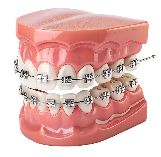 teeth model with braces