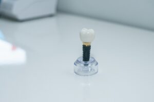 Dentist discussing dental implants with a patient in a modern office