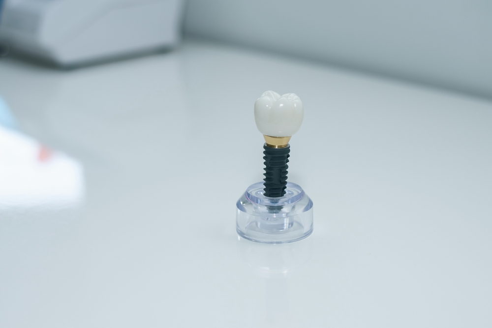 Dentist discussing dental implants with a patient in a modern office
